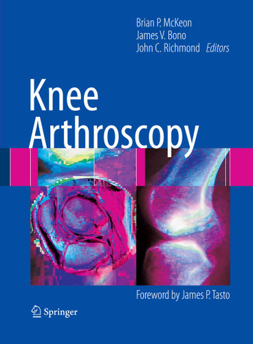 Knee Arthroscopy book cover by 