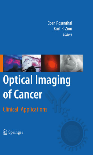 Optical Imaging of Cancer: Clinical Applications book cover by 