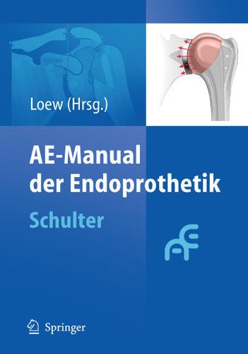 AE-Manual der Endoprothetik: Schulter book cover by 