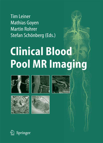 Clinical Blood Pool MR Imaging book cover by 