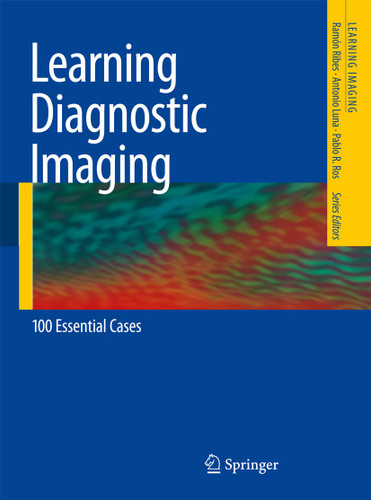 Learning Diagnostic Imaging: 100 Essential Cases (Learning Imaging) book cover by Ramón Ribes, Antonio Luna, Pablo R. Ros