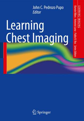 Learning Chest Imaging (Learning Imaging) book cover by 