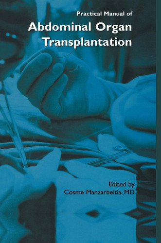 Practical Manual of Abdominal Organ Transplantation book cover by 