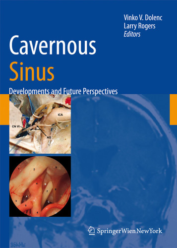 Cavernous Sinus: Developments and Future Perspectives book cover by 