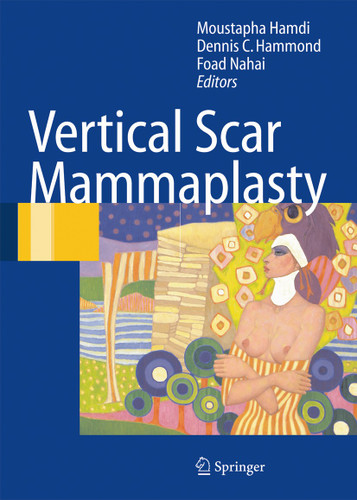 Vertical Scar Mammaplasty book cover by 