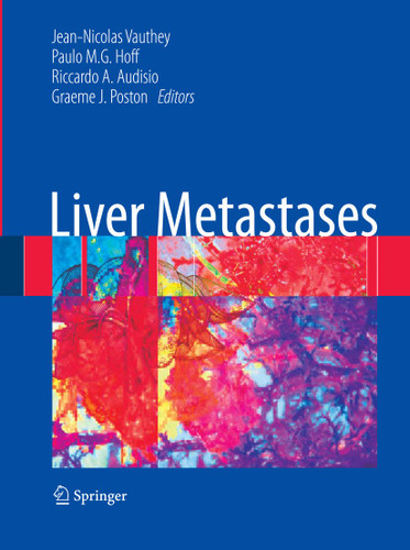 Liver Metastases book cover by 