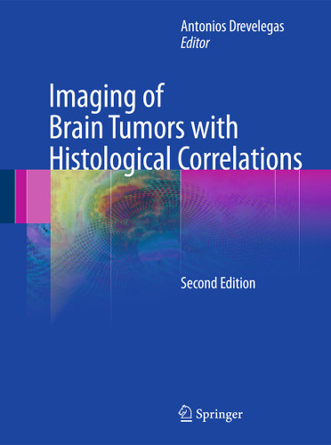 Imaging of Brain Tumors with Histological Correlations book cover by 