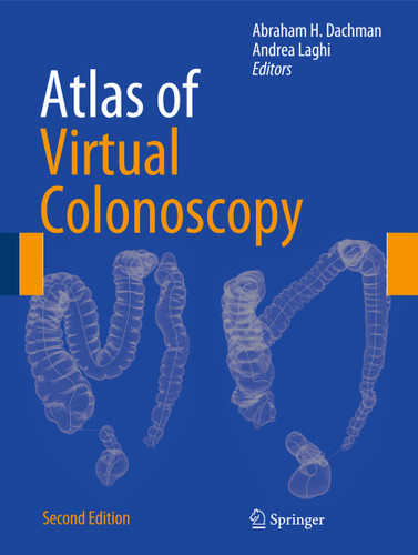 Atlas of Virtual Colonoscopy book cover by 