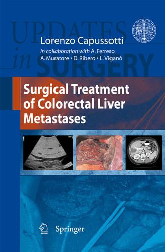 Surgical Treatment of Colorectal Liver Metastases (Updates in Surgery) book cover by 