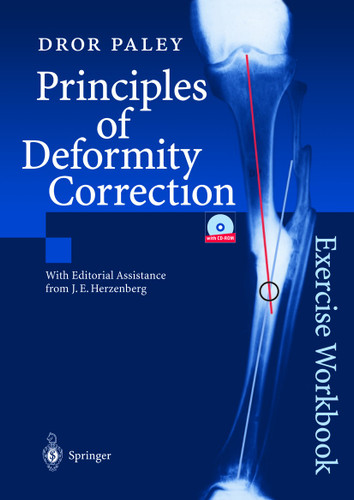 Principles of Deformity Correction: Exercise Workbook book cover by Dror Paley