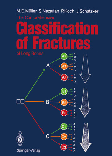 The Comprehensive Classification of Fractures of Long Bones book cover by Maurice E. Müller, Serge Nazarian, Peter Koch, Joseph Schatzker