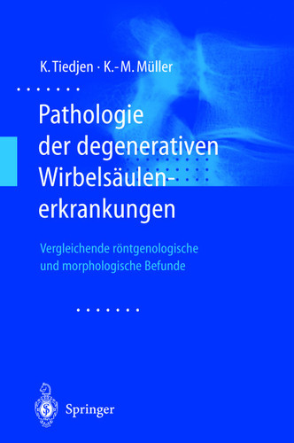 Pathologie der degenerativen Wirbelsäulenerkrankungen: Vergleichende röntgenologische und morphologische Befunde book cover by Kay Tiedjen, Klaus-Michael Müller