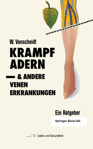 Krampfadern und andere Venenerkrankungen: Ein Ratgeber (Leben und Gesundheit) book cover by W. Vanscheidt