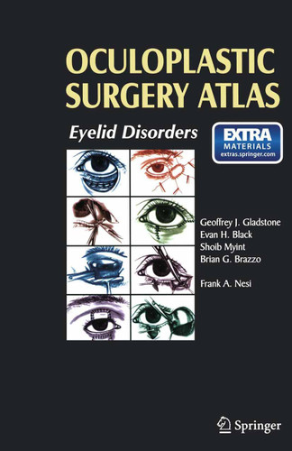 Oculoplastic Surgery Atlas: Eyelid Disorders book cover by 