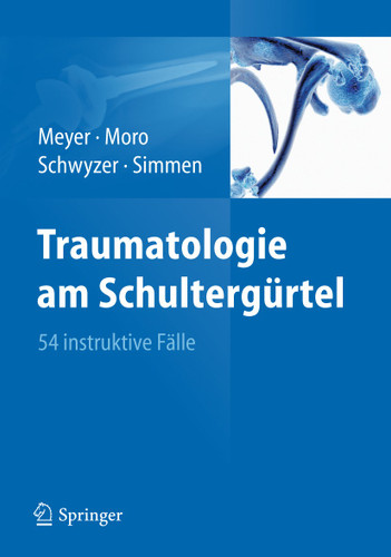 Traumatologie am Schultergürtel: 54 instruktive Fälle book cover by Rainer-Peter Meyer, Fabrizio Moro, Hans-Kaspar Schwyzer, Beat René Simmen