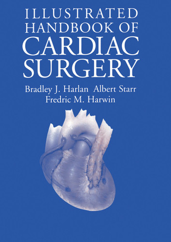 Illustrated Handbook of Cardiac Surgery book cover by Bradley J. Harlan, Albert Starr, Fredric M. Harwin