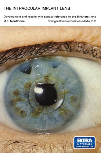 The Intraocular Implant Lens Development and Results with Special Reference to the Binkhorst Lens: Proefschrift book cover by Marcel Eugène Nordlohne