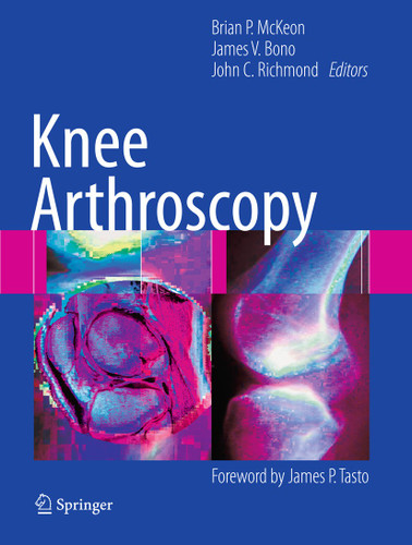 Knee Arthroscopy book cover by 