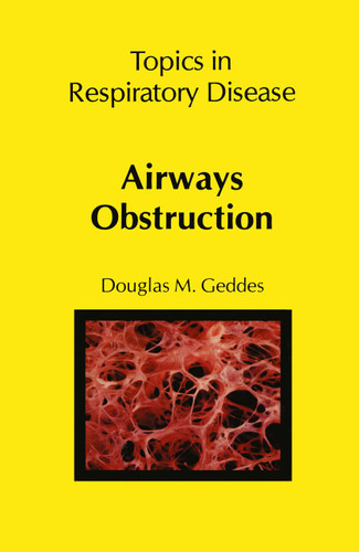 Airways Obstruction book cover by D.M. Geddes