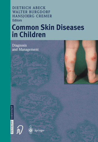 Common Skin Diseases in Children: Diagnosis and Management book cover by 