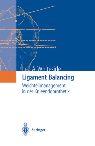 Ligament Balancing: Weichteilmanagement in der Knieendoprothetik book cover by Leo A. Whiteside