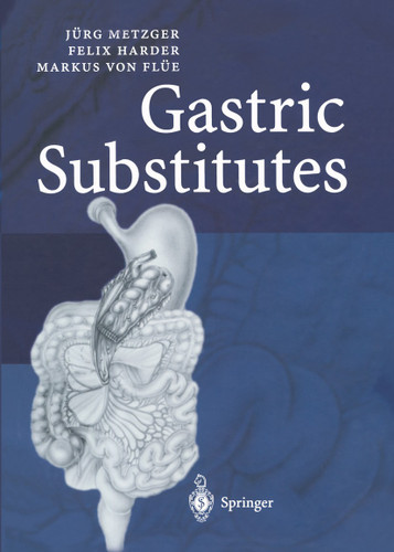 Gastric Substitutes book cover by Jürg Metzger, Felix Harder, Markus von Flüe