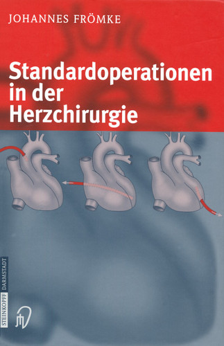 Standardoperationen in der Herzchirurgie book cover by Johannes Frömke