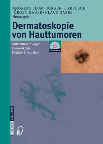 Dermatoskopie von Hauttumoren: Auflichtmikroskopie — Dermoskopie — Digitale Bildanalyse book cover by 