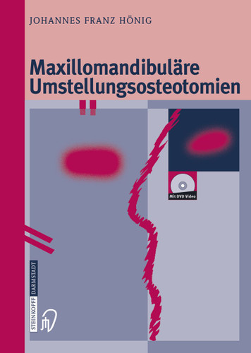 Maxillomandibuläre Umstellungsosteotomien book cover by Johannes-Franz Hönig