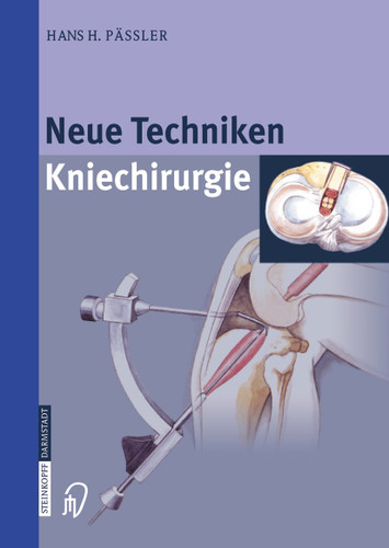 Neue Techniken Kniechirurgie book cover by H.H. Pässler