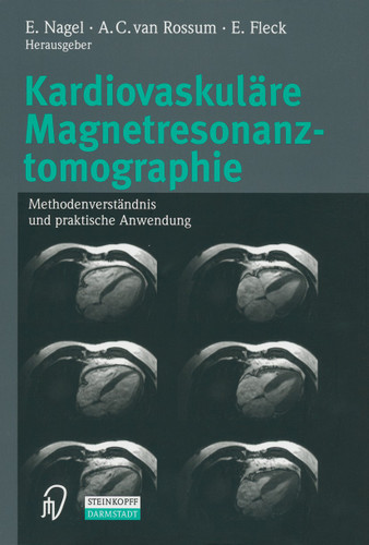 Kardiovaskuläre Magnetresonanztomographie: Methodenverständnis und praktische Anwendung book cover by 