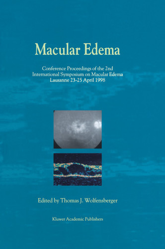 Macular Edema: Conference Proceedings of the 2nd International Symposium on Macular Edema, Lausanne, 23–25 April 1998 book cover by 