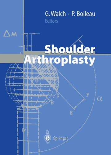 Shoulder Arthroplasty book cover by 