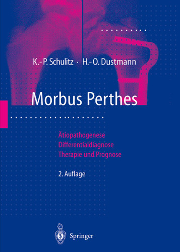Morbus Perthes: Ätiopathogenese, Differentialdiagnose, Therapie und Prognose book cover by Klaus-Peter Schulitz, Hans-Otto Dustmann