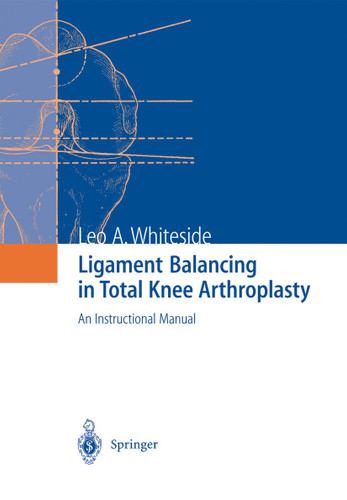 Ligament Balancing in Total Knee Arthroplasty: An Instructional Manual book cover by Leo A. Whiteside
