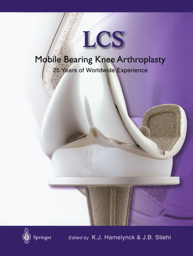 LCS® Mobile Bearing Knee Arthroplasty: A 25 Years Worldwide Review book cover by 