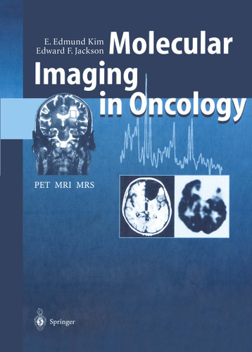 Molecular Imaging in Oncology: PET, MRI, and MRS book cover by E. Edmund Kim, Edward F. Jackson