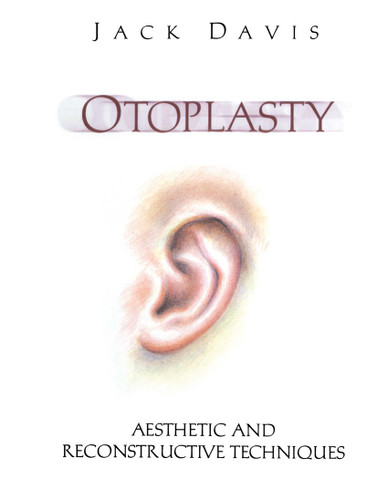 Otoplasty: Aesthetic and Reconstructive Techniques book cover by Jack Davis