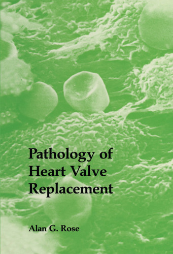 Pathology of Heart Valve Replacement book cover by A.G. Rose