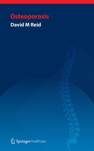 Handbook of Osteoporosis book cover by David Reid
