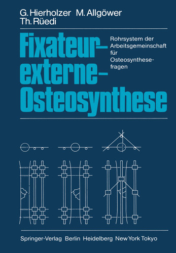 Fixateur-externe-Osteosynthese: Rohrsystem der Arbeitsgemeinschaft für Osteosynthesefragen book cover by G. Hierholzer, M. Allgöwer, T. Rüedi