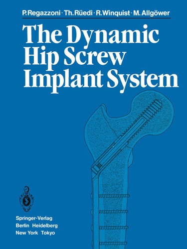 The Dynamic Hip Screw Implant System book cover by P. Regazzoni, T. Rüedi, R. Winquist, M. Allgöwer