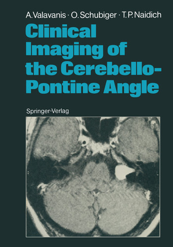 Clinical Imaging of the Cerebello-Pontine Angle book cover by Anton Valavanis, Othmar Schubiger, Thomas P. Naidich