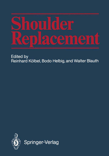 Shoulder Replacement book cover by 