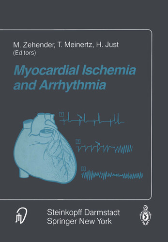 Myocardial Ischemia and Arrhythmia: Under the auspices of the Society of Cooperation in Medicine and Science (SCMS), Freiburg, Germany book cover by 