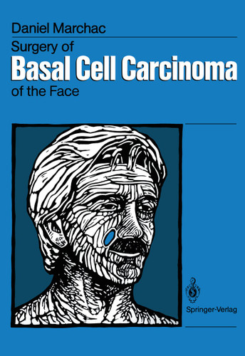 Surgery of Basal Cell Carcinoma of the Face book cover by Daniel Marchac