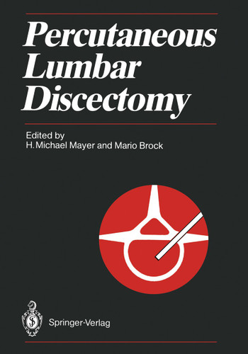 Percutaneous Lumbar Discectomy book cover by 