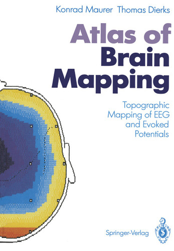 Atlas of Brain Mapping: Topographic Mapping of EEG and Evoked Potentials book cover by Konrad Maurer, Thomas Dierks