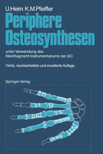 Periphere Osteosynthesen: unter Verwendung des Kleinfragment-Instrumentariums der AO book cover by Urs Heim, Karl M. Pfeiffer
