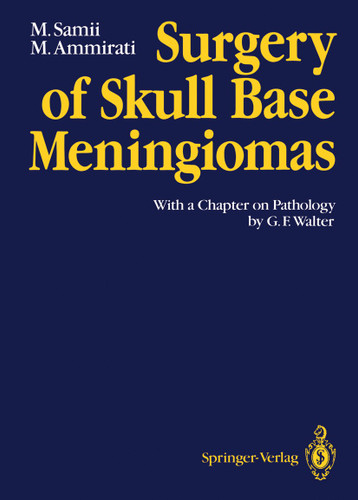 Surgery of Skull Base Meningiomas: With a Chapter on Pathology by G. F. Walter book cover by Madjid Samii, Mario Ammirati
